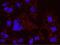 Lysine Demethylase 5A antibody, NB110-40499, Novus Biologicals, Proximity Ligation Assay image 