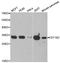 Eukaryotic Translation Elongation Factor 1 Beta 2 antibody, LS-C335690, Lifespan Biosciences, Western Blot image 