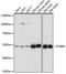 Tubulin Beta 3 Class III antibody, 16-852, ProSci, Western Blot image 
