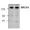 BRCA1 DNA Repair Associated antibody, NBP1-45410, Novus Biologicals, Western Blot image 