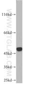 SET And MYND Domain Containing 2 antibody, 21290-1-AP, Proteintech Group, Western Blot image 