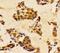 Phosphatidylinositol-4,5-Bisphosphate 3-Kinase Catalytic Subunit Alpha antibody, LS-C175861, Lifespan Biosciences, Immunohistochemistry frozen image 