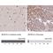 Zinc Finger And BTB Domain Containing 7A antibody, NBP2-38550, Novus Biologicals, Immunohistochemistry paraffin image 