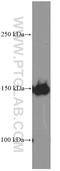Platelet Derived Growth Factor Receptor Alpha antibody, 60045-1-Ig, Proteintech Group, Western Blot image 