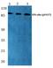 Interferon Gamma Receptor 1 antibody, PA5-36812, Invitrogen Antibodies, Western Blot image 