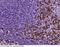 PD-L1 antibody, 10084-T24, Sino Biological, Immunohistochemistry frozen image 