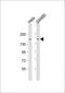 Erbb2 Interacting Protein antibody, MBS9216878, MyBioSource, Western Blot image 