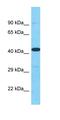 Polyhomeotic 2 homolog antibody, orb327193, Biorbyt, Western Blot image 