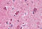 Pro-Apoptotic WT1 Regulator antibody, MBS245602, MyBioSource, Immunohistochemistry frozen image 