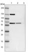 UPF3B Regulator Of Nonsense Mediated MRNA Decay antibody, PA5-51638, Invitrogen Antibodies, Western Blot image 