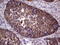 Transforming Acidic Coiled-Coil Containing Protein 1 antibody, M04196, Boster Biological Technology, Immunohistochemistry paraffin image 