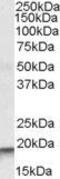 Actin Related Protein 2/3 Complex Subunit 4 antibody, GTX88495, GeneTex, Western Blot image 