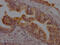 Dipeptidyl Peptidase 4 antibody, CSB-RA927191A0HU, Cusabio, Immunohistochemistry paraffin image 
