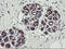 TPD52 Like 3 antibody, LS-C174080, Lifespan Biosciences, Immunohistochemistry paraffin image 