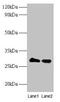 Thiopurine S-Methyltransferase antibody, CSB-PA00585A0Rb, Cusabio, Western Blot image 