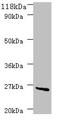 Purine nucleoside phosphorylase DeoD-type antibody, A53072-100, Epigentek, Western Blot image 