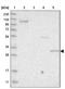 Sulfotransferase Family 1B Member 1 antibody, NBP1-86995, Novus Biologicals, Western Blot image 
