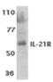 Interleukin 21 Receptor antibody, orb86769, Biorbyt, Western Blot image 