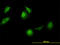 Chaperonin Containing TCP1 Subunit 5 antibody, LS-B5451, Lifespan Biosciences, Immunofluorescence image 