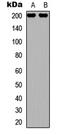 Tubulin Gamma Complex Associated Protein 6 antibody, LS-B14485, Lifespan Biosciences, Western Blot image 