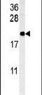 SFT2 Domain Containing 3 antibody, PA5-25192, Invitrogen Antibodies, Western Blot image 