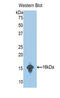 Complement Factor B antibody, LS-C299906, Lifespan Biosciences, Western Blot image 