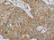 Matrix Metallopeptidase 8 antibody, CSB-PA220976, Cusabio, Immunohistochemistry paraffin image 