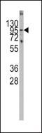 Poly(ADP-Ribose) Glycohydrolase antibody, PA5-14158, Invitrogen Antibodies, Western Blot image 