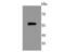 Nuclear Receptor Subfamily 4 Group A Member 1 antibody, A00626-1, Boster Biological Technology, Western Blot image 