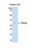 Carbonic Anhydrase 2 antibody, LS-C294050, Lifespan Biosciences, Western Blot image 