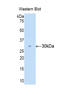 Carbonic anhydrase C antibody, LS-C294050, Lifespan Biosciences, Western Blot image 