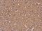 Tubulin Beta 3 Class III antibody, GTX130245, GeneTex, Immunohistochemistry paraffin image 