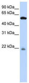 Peptidase M20 Domain Containing 2 antibody, TA339954, Origene, Western Blot image 