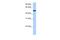 Butyrophilin Like 8 antibody, A12676, Boster Biological Technology, Western Blot image 