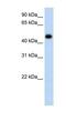 Hydroxyacid Oxidase 1 antibody, NBP1-55294, Novus Biologicals, Western Blot image 
