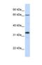 Beta-1,3-Galactosyltransferase 1 antibody, NBP1-69328, Novus Biologicals, Western Blot image 