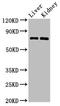 PR/SET Domain 5 antibody, LS-C675093, Lifespan Biosciences, Western Blot image 