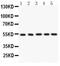 Arylsulfatase A antibody, PA5-78824, Invitrogen Antibodies, Western Blot image 