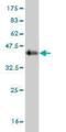 Succinate Dehydrogenase Complex Subunit C antibody, H00006391-M02, Novus Biologicals, Western Blot image 