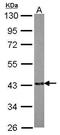 EMAP Like 2 antibody, PA5-30494, Invitrogen Antibodies, Western Blot image 