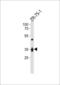 Interleukin 3 Receptor Subunit Alpha antibody, LS-C203952, Lifespan Biosciences, Western Blot image 