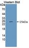 Cytokine Inducible SH2 Containing Protein antibody, LS-C374452, Lifespan Biosciences, Western Blot image 