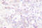 RNA Polymerase II Subunit A antibody, LS-C176296, Lifespan Biosciences, Immunohistochemistry paraffin image 