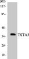 Tissue Specific Transplantation Antigen P35B antibody, A09921-1, Boster Biological Technology, Western Blot image 