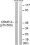 Dihydropyrimidinase Like 2 antibody, abx012682, Abbexa, Western Blot image 