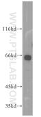 Growth arrest-specific protein 8 antibody, 18270-1-AP, Proteintech Group, Western Blot image 