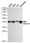 Glycogen Synthase Kinase 3 Beta antibody, STJ99095, St John