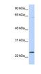 ChaC Glutathione Specific Gamma-Glutamylcyclotransferase 1 antibody, NBP1-57685, Novus Biologicals, Western Blot image 