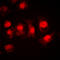Ribosomal Protein S6 Kinase A5 antibody, LS-C358299, Lifespan Biosciences, Immunofluorescence image 