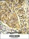 Clathrin Light Chain A antibody, 63-742, ProSci, Immunohistochemistry paraffin image 